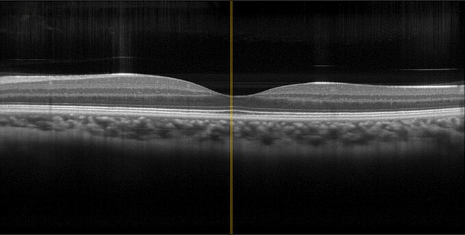 Physik Instrumente OCT Test Image