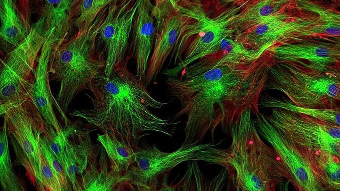 全内反射荧光显微术(TIRFM)的定位解决方案